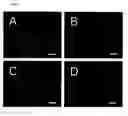 Fig. 02 - Methods for treating inflammatory disorders using regulators of microvessel dilations