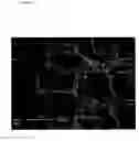 Fig. 12 - Methods for treating inflammatory disorders using regulators of microvessel dilations