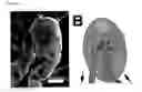 Fig. 16 - Methods for treating inflammatory disorders using regulators of microvessel dilations