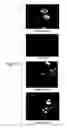 Fig. 11 - Erastin and erastin binding proteins, and uses thereof