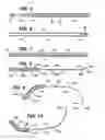 Fig. 05 - Coordinate instrument set