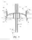 Fig. 04 - Infusion set