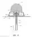 Fig. 09 - Infusion set