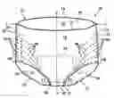 Fig. 01 - Disposable absorbent article having removable portions