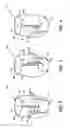 Fig. 03 - Disposable absorbent article having removable portions