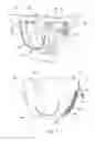 Fig. 04 - Disposable absorbent articles having multiple absorbent core components including replaceable components