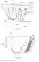 Fig. 08 - Disposable absorbent articles having multiple absorbent core components including replaceable components