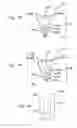 Fig. 52 - Disposable absorbent articles having multiple absorbent core components including replaceable components