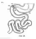 Fig. 05 - Removal and repositioning device