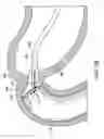 Fig. 06 - Removal and repositioning device