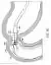 Fig. 07 - Removal and repositioning device