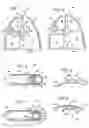 Fig. 02 - Constriction device including reinforced suture holes