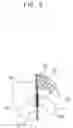 Fig. 09 - Esophageal stent