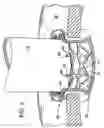 Fig. 03 - Anastomosis device with separable section