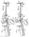 Fig. 08 - Anastomosis device with separable section