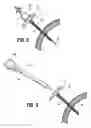 Fig. 05 - Radially expandable access system including trocar seal