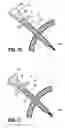 Fig. 06 - Radially expandable access system including trocar seal