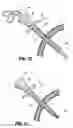 Fig. 07 - Radially expandable access system including trocar seal