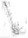 Fig. 02 - Surgical stapling instrument having load sensing control circuitry
