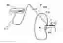 Fig. 01 - Methods for catheter-based renal denervation