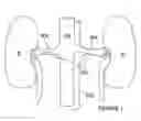 Fig. 02 - Methods for catheter-based renal denervation