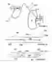 Fig. 04 - Methods for catheter-based renal denervation
