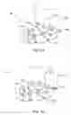 Fig. 02 - Gastrointestinal volume manipulation