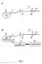 Fig. 02 - Method of treating depression, mood disorders and anxiety disorders using neuromodulation