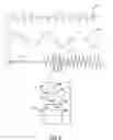 Fig. 07 - Differential neurostimulation therapy driven by physiological therapy
