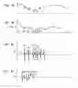 Fig. 05 - Multirate cochlear stimulation strategy and apparatus