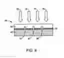 Fig. 06 - Method and apparatus for treating a diseased nail