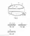 Fig. 03 - Graft systems having filling structures supported by scaffolds and methods for their use