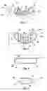 Fig. 02 - Intervertebral spacer
