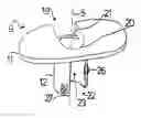 Fig. 01 - Knee joint prosthesis