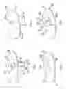 Fig. 02 - Knee joint prosthesis