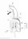 Fig. 04 - Partial hand prosthesis
