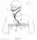 Fig. 02 - Real-time snoring assessment apparatus and method