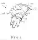 Fig. 02 - Partially removable glove