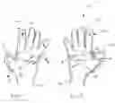 Fig. 04 - Partially removable glove