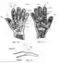 Fig. 10 - Partially removable glove