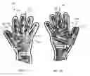 Fig. 13 - Partially removable glove