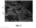 Fig. 04 - Coating for rubber gloves