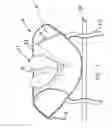 Fig. 08 - Mattress sled