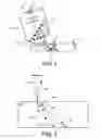 Fig. 02 - Multiangle ultrasound imager