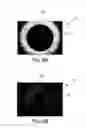 Fig. 07 - Multiangle ultrasound imager