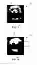 Fig. 08 - Multiangle ultrasound imager