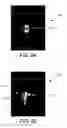 Fig. 09 - Multiangle ultrasound imager