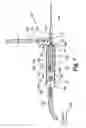 Fig. 02 - Tissue transplantation method and apparatus