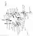 Fig. 04 - Wheelchair suspension