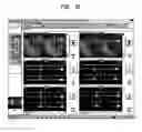 Fig. 12 - Detector head position correction for hybrid SPECT/CT imaging apparatus